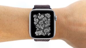 Estudio alerta: casi todas las correas de relojes inteligentes están contaminadas con bacterias