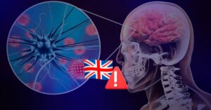 Brote de meningitis en Canterbury deja dos muertos y 29 casos entre estudiantes