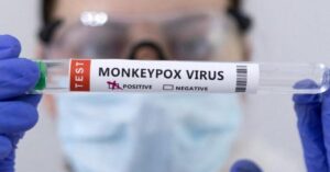 Acusan a dos científicos de contrabandear virus de viruela del mono a EE.UU.