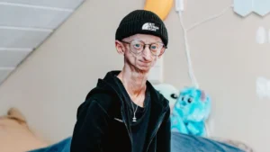 Muere a los 28 años Michiel Vandeweert, influencer belga con progeria